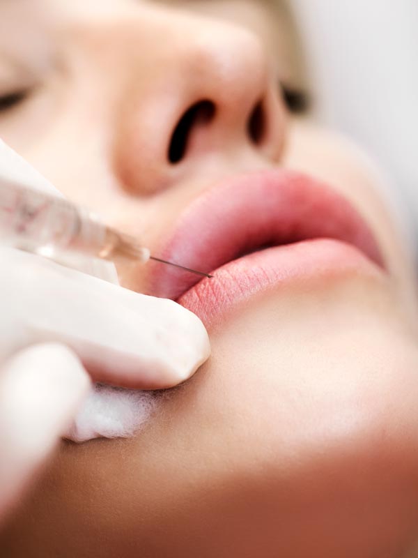 lip injectable