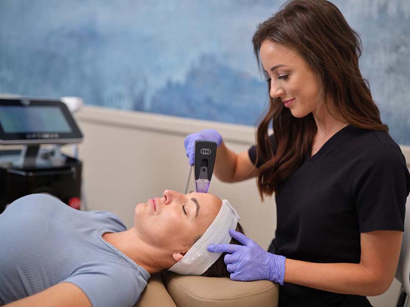 microneedling treatment